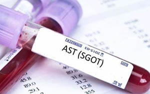 谷草轉氨酶（AST/GOT）檢測試劑盒用原輔料