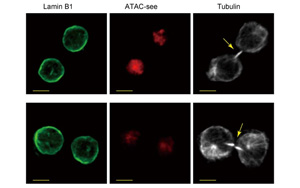 是什么決定了CD8+ T細(xì)胞的命運(yùn)？Immunity新研究指向cBAF復(fù)合物