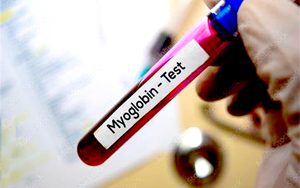 肌紅蛋白（Myo）-磁微粒化學(xué)發(fā)光（AE/AP） /熒光免疫層析解決方案