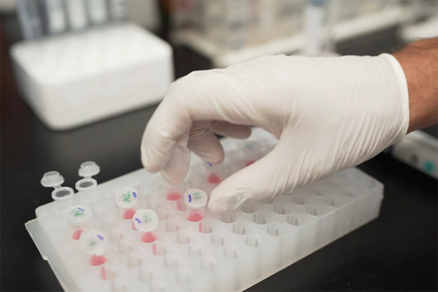 阿爾茲海默癥早期診斷標志物