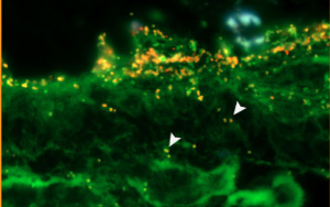 PNAS新研究：致病菌利用腸道黏液層中的一種糖來感染腸道