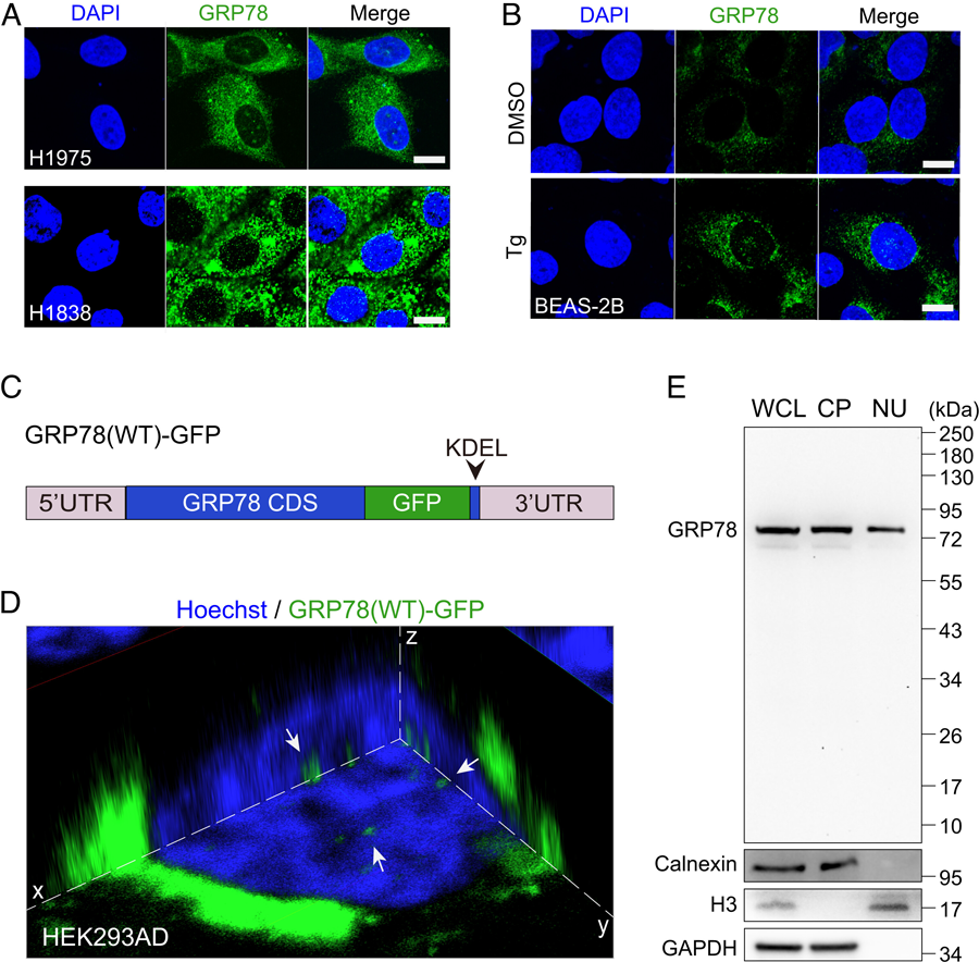 GRP78定位于人癌癥細(xì)胞和內(nèi)質(zhì)網(wǎng)應(yīng)激細(xì)胞的細(xì)胞核。