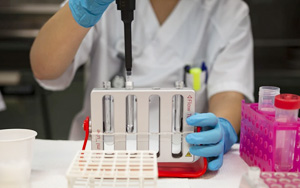 糖鏈抗原19-9(CA19-9)-磁微粒化學(xué)發(fā)光（吖啶酯）解決方案