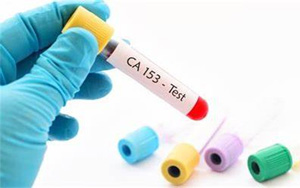 糖類抗原15-3(CA15-3)-磁微?；瘜W(xué)發(fā)光法（AE/AP）解決方案