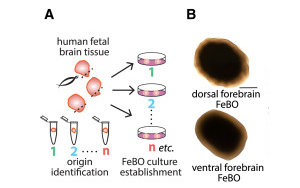 《Cell》新型組織衍生的大腦類(lèi)器官可能會(huì)給大腦研究帶來(lái)革命性的變化