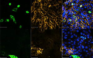 Nature最新研究表明，一類新的抗病毒藥物可以對(duì)抗SARS-CoV-2