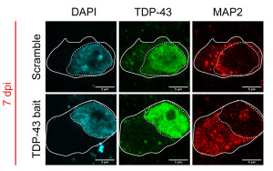 Cell Stem Cell：利用類(lèi)器官保護(hù)癡呆和ALS中受到的腦損傷