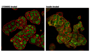 Nature最新發(fā)現(xiàn)控制CAR-T細(xì)胞壽命的蛋白質(zhì)！