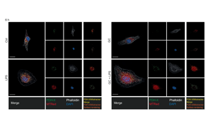 《Nature》第一次揭開(kāi)糖皮質(zhì)激素如何激活人體對(duì)炎癥的自然“剎車(chē)”