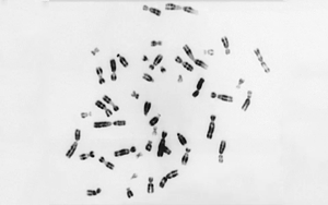 Nature：未知的補償機制——細胞如何處理額外的染色體